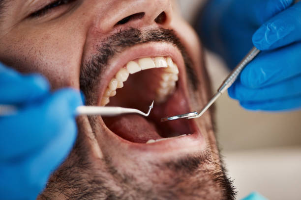 Best Emergency Gum Pain Relief  in Mineral Springs, AR